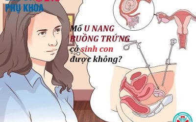 [Giải đáp] Mổ u nang buồng trứng có sinh con được không?