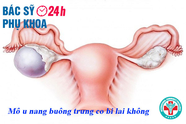 mo-u-nang-buong-trung-co-the-bi-lai-khong